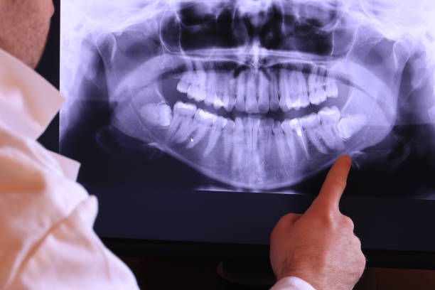 Best Emergency X-Rays and Diagnostics in Deer Lodge, MT